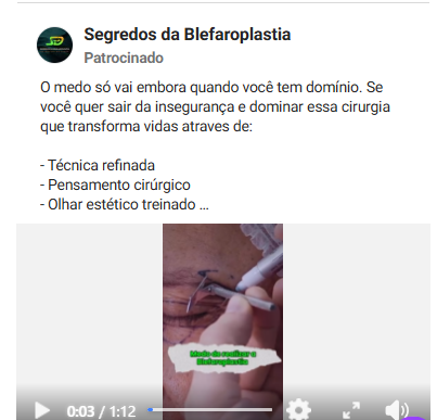 Referência 10 - Segredos da Blefaroplastia