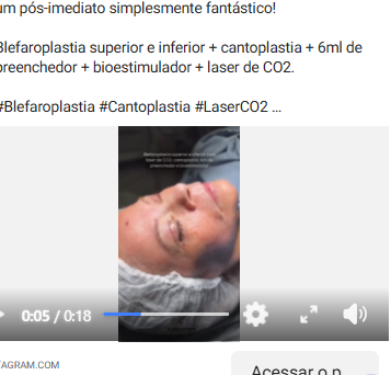 Referência 7